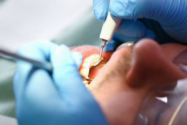 Best Emergency Root Canal Therapy in Presque Isle, ME